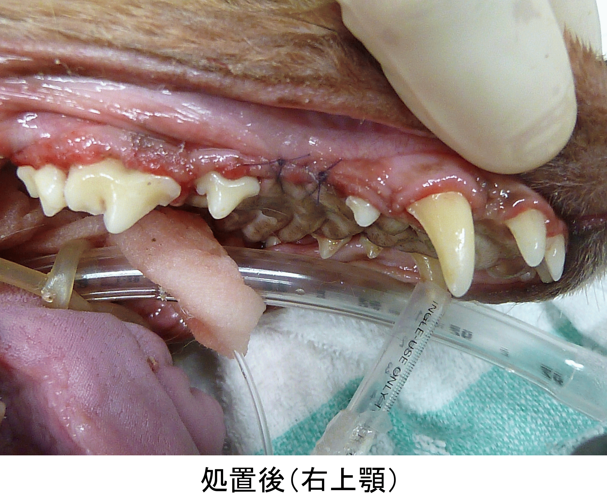 抗生 物質 歯医者
